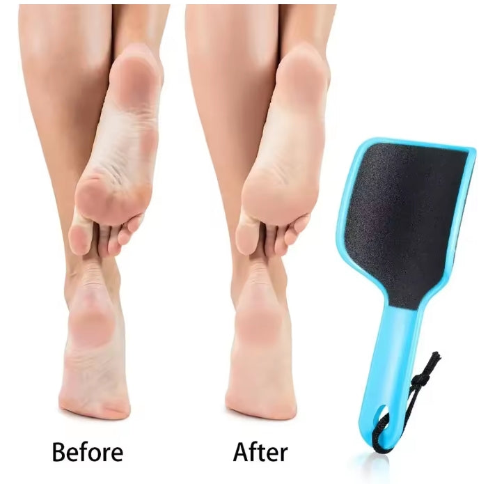 U-Shape Foot File Callus Remover